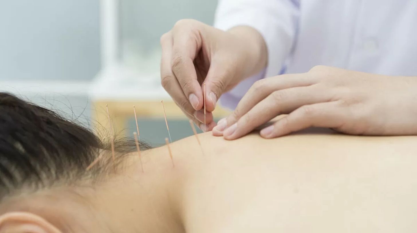 Acupuncture for Neck Pain: Relieve Tension, Stiffness, and Improve Mobility Naturally